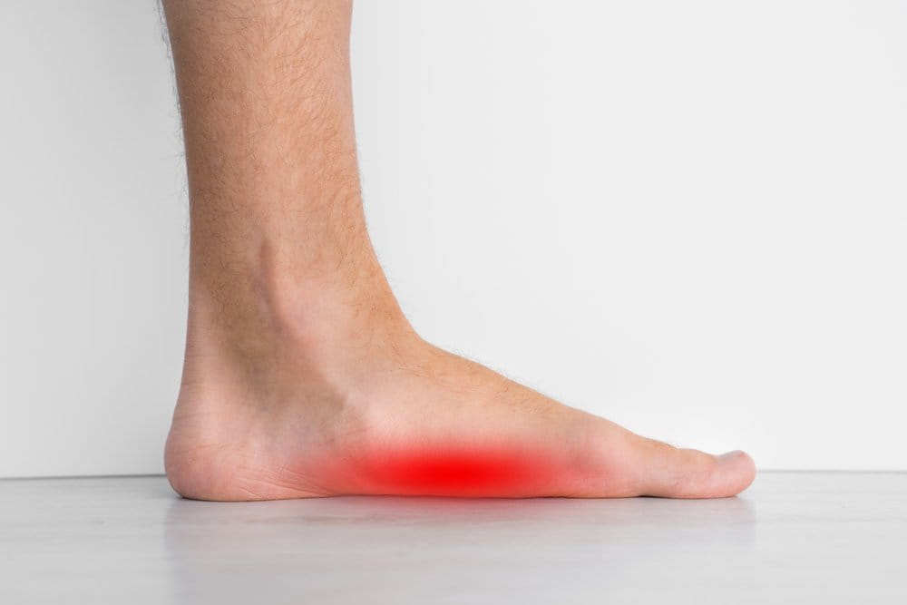 flat foot